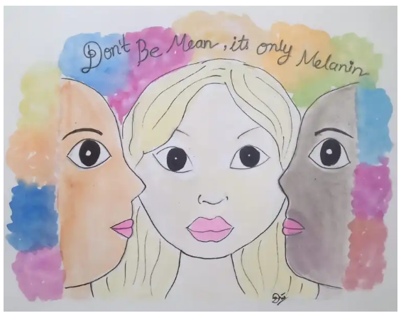 International Albinism Awareness Day