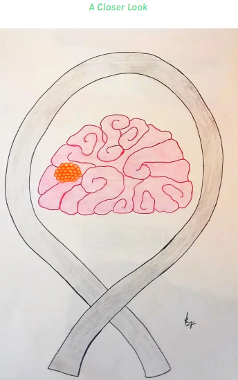 World Brain Tumour Day